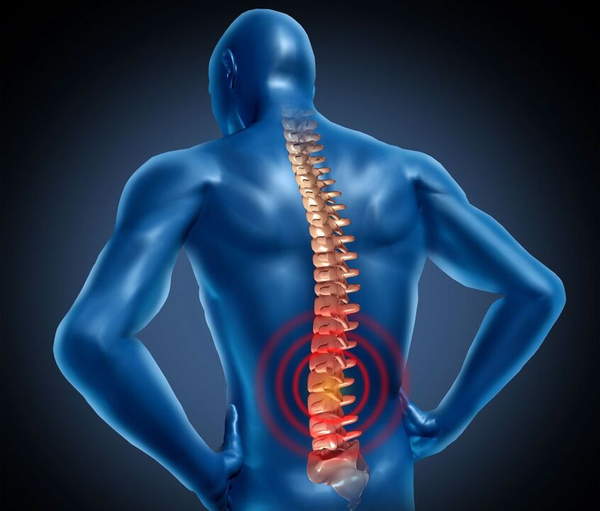 Nimme osteokondroos