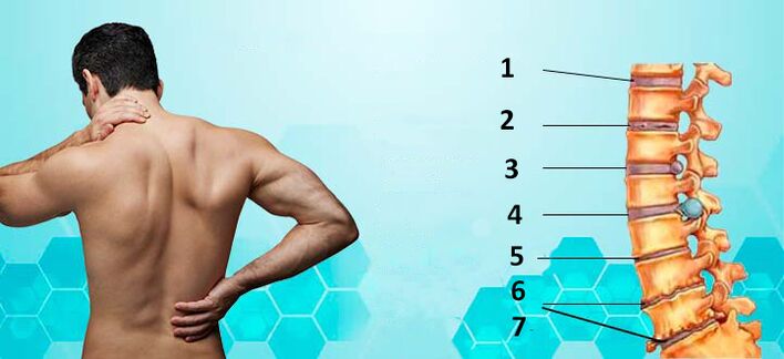 Osteokondroosi arenguetapid