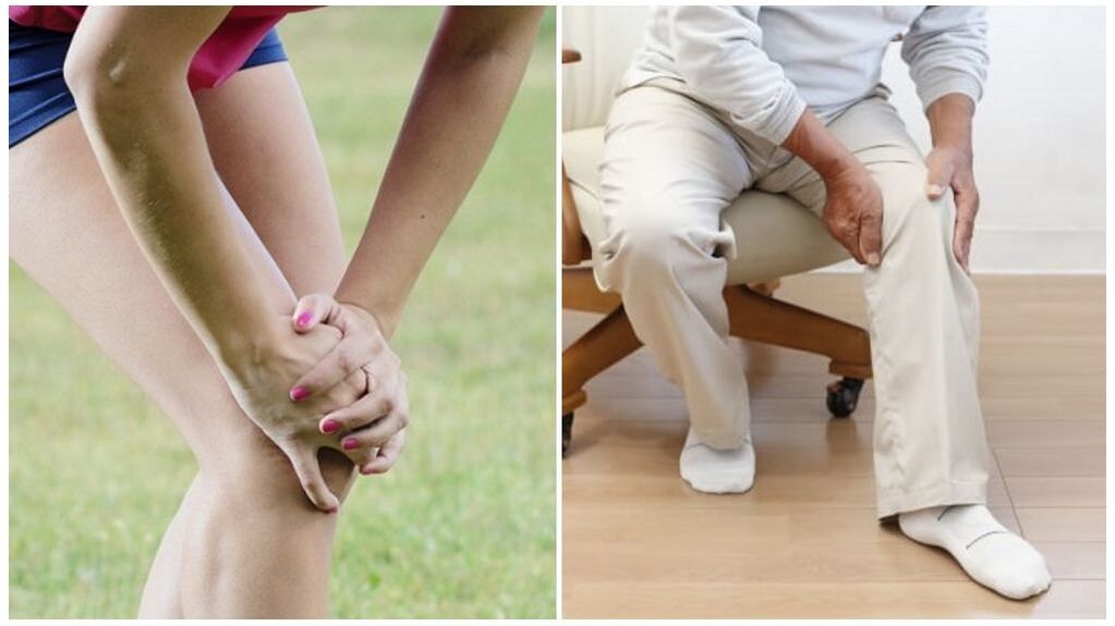 Põlveliigese artroosi peamised põhjused on vigastused ja vanusega seotud muutused